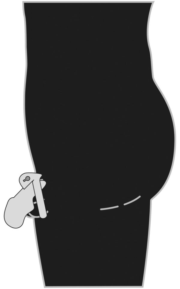 Penis cage glans - obrazek 9